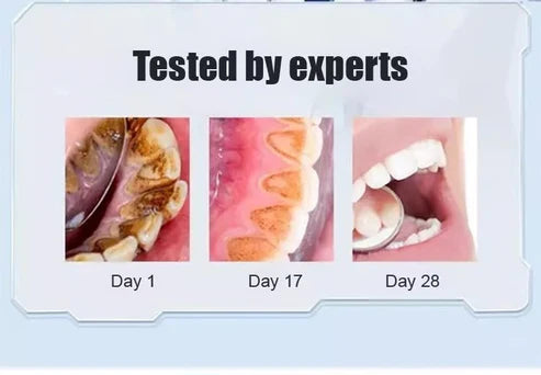Whitening Toothpaste ( BUY 1 GET ONE FREE )